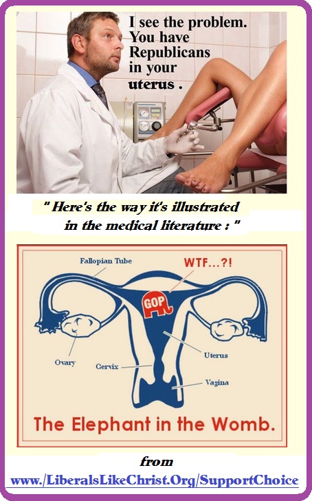 GOPinUterus.